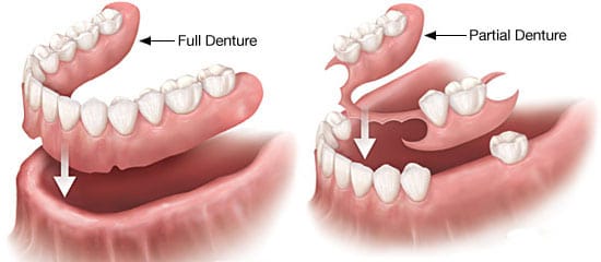 dentures in kenosha, partial dentures in kenosha, kenosha dental practice